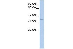 WB Suggested Anti-CA4 Antibody Titration:  5. (CA4 Antikörper  (Middle Region))