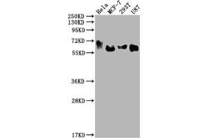 Western Blot Positive WB detected in: Hela whole cell lysate, MCF-7 whole cell lysate, 293T whole cell lysate, U87 whole cell lysate All lanes: GBA antibody at 1:2000 Secondary Goat polyclonal to rabbit IgG at 1/50000 dilution Predicted band size: 60, 58, 55, 51, 30 kDa Observed band size: 60 kDa (Rekombinanter GBA Antikörper)