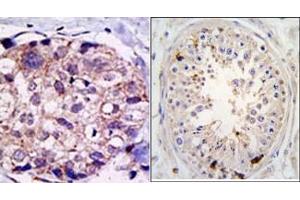 Image no. 1 for anti-Ubiquitin Specific Peptidase 2 (USP2) (C-Term) antibody (ABIN357521) (USP2 Antikörper  (C-Term))