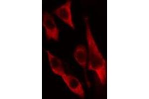 ABIN6274653 staining HeLa cells by IF/ICC. (CYP2U1 Antikörper  (Internal Region))