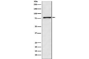 Western blot analysis of Fructose 6 Phosphate Kinase expression in HeLa cell lysate. (Rekombinanter PFKM Antikörper)