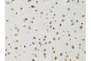 Immunohistochemistry of paraffin-embedded rat brain using TMPO Antibody (ABIN1875122) at dilution of 1:100 (40x lens). (Thymopoietin Antikörper)