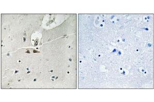 Immunohistochemical analysis of paraffin-embedded human brain tissue using Ephrin B1/B2/B3 (Phospho-Tyr324) antibody (left)or the same antibody preincubated with blocking peptide (right). (Ephrin B1 Antikörper  (pTyr324))