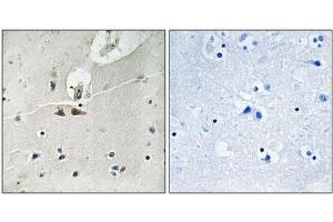 Immunohistochemical analysis of paraffin-embedded human brain tissue using Ephrin B1/B2/B3 (Phospho-Tyr324) antibody (left)or the same antibody preincubated with blocking peptide (right). (EFNB1/EFNB2/EFNB3 (pTyr324) Antikörper)
