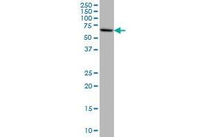 EPM2AIP1 monoclonal antibody (M01), clone 3H7 Western Blot analysis of EPM2AIP1 expression in HeLa . (EPM2AIP1 Antikörper  (AA 508-606))