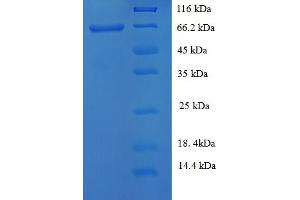 SDS-PAGE (SDS) image for Keratin 38 (KRT38) (AA 2-456) protein (His-SUMO Tag) (ABIN5709829) (KRT38 Protein (AA 2-456) (His-SUMO Tag))