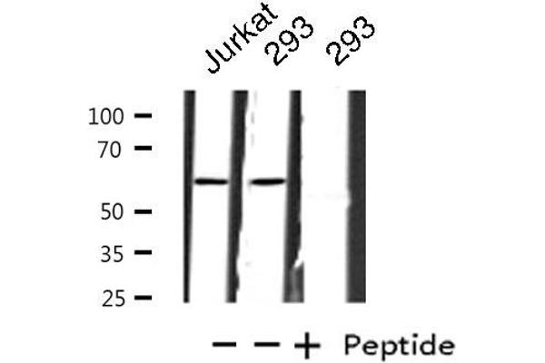 ZNF695 Antikörper  (C-Term)