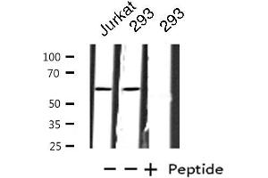 Western blot analysis of extracts from Jurkat/293 cells, using ZNF695 antibody. (ZNF695 Antikörper  (C-Term))