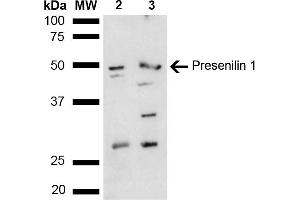 Western blot analysis of Mouse, Rat liver lysate showing detection of ~52. (Presenilin 1 Antikörper  (AA 100-200) (Biotin))