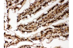 Immunohistochemistry (IHC) image for anti-Lamin A/C (LMNA) (AA 481-646) antibody (ABIN3043295)
