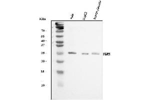 Western blot analysis of SNAP23 using anti-SNAP23 antibody (ABIN7603236). (SNAP23 Antikörper  (N-Term))