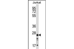 ARHGDIB Antibody (C-term) (ABIN657665 and ABIN2846658) western blot analysis in Jurkat cell line lysates (35 μg/lane).