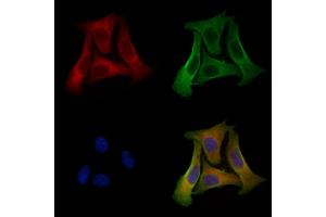 ABIN6256878 and ABIN6274572 staining Hela cells by IF/ICC. (Serotonin Receptor 2B Antikörper  (Internal Region))