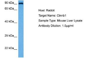 Host:  Rabbit  Target Name:  CTNNB1  Sample Tissue:  Mouse Liver  Antibody Dilution:  1ug/ml (CTNNB1 Antikörper  (C-Term))