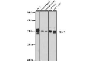 Western blot analysis of extracts of various cell lines, using SRSF7 Rabbit pAb (ABIN7270548) at 1:1000 dilution. (SFRS7 Antikörper  (AA 60-120))