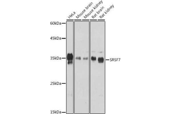 SFRS7 Antikörper  (AA 60-120)