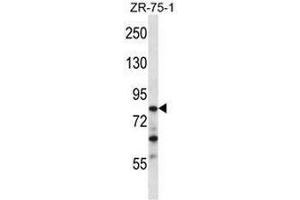 CNOT3 Antibody (N-term) western blot analysis in ZR-75-1 cell line lysates (35µg/lane). (CNOT3 Antikörper  (N-Term))