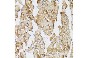 Immunohistochemistry of paraffin-embedded mouse heart using CASP3 antibody (ABIN4903140) at dilution of 1:100 (40x lens).