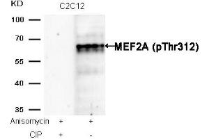 Western blot analysis of extracts from C2C12 cells, treated with Anisomycin or calf intestinal phosphatase (CIP), using MEF2A (Phospho-Thr312) Antibody. (MEF2A Antikörper  (pThr312))