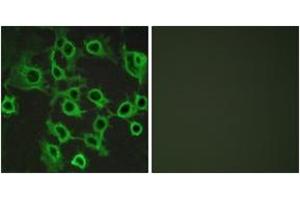 Immunofluorescence analysis of COS7 cells, using CCRL2 Antibody. (CCRL2 Antikörper  (AA 141-190))