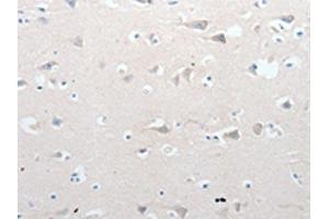 The image on the left is immunohistochemistry of paraffin-embedded Human brain tissue using ABIN7190766(GCH1 Antibody) at dilution 1/15, on the right is treated with synthetic peptide. (GCH1 Antikörper)