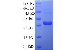LSM10 Protein (AA 1-123, full length) (His-SUMO Tag)