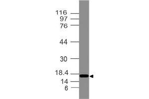 Image no. 1 for anti-Developmental Pluripotency Associated 3 Pseudogene 2 (DPPA3P2) antibody (ABIN5027789) (STELLAR Antikörper)