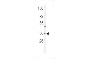 M6PR Antibody (C-term) (ABIN650726 and ABIN2839414) western blot analysis in A549 cell line lysates (35 μg/lane).