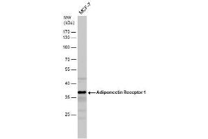WB Image Adiponectin Receptor 1 antibody detects Adiponectin Receptor 1 protein by western blot analysis.