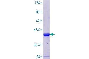 C17orf37 Protein (AA 1-115) (GST tag)