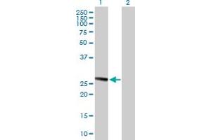 Western Blot analysis of TMED1 expression in transfected 293T cell line by TMED1 MaxPab polyclonal antibody.