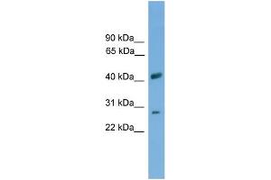 WB Suggested Anti-SLC25A37 Antibody Titration: 0. (SLC25A37 Antikörper  (Middle Region))