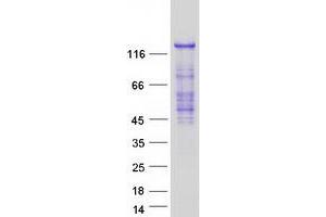 Ras Protein-Specific Guanine Nucleotide-Releasing Factor 2 (RASGRF2) protein (Myc-DYKDDDDK Tag)
