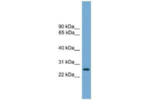 LRRC3 antibody used at 1 ug/ml to detect target protein. (LRRC3 Antikörper  (Middle Region))