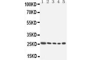 Anti-HOXA6 antibody, Western blotting Lane 1: SW620 cell Lysate Lane 2: SW620 cell Lysate Lane 3: HELA cell Lysate Lane 4:  cell Lysate Lane 5:  cell Lysate