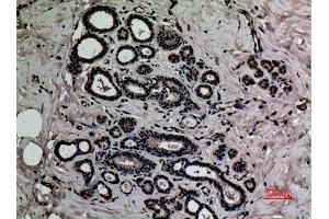 Immunohistochemistry (IHC) analysis of paraffin-embedded Human Breast, antibody was diluted at 1:100. (HMGB1 Antikörper  (acLys12))