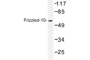 Image no. 1 for anti-Frizzled Family Receptor 10 (FZD10) antibody (ABIN317639) (FZD10 Antikörper)