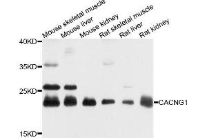 Western blot analysis of extracts of various cells, using CACNG1 antibody.