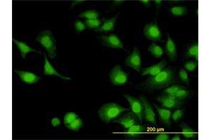 Immunofluorescence of monoclonal antibody to IRAK1 on HeLa cell. (IRAK1 Antikörper  (AA 530-693))