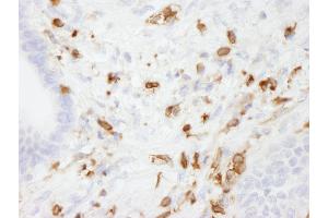 Immunohistochemistry (IHC) image for anti-Coronin, Actin Binding Protein, 1A (CORO1A) (AA 250-300) antibody (ABIN7448482)