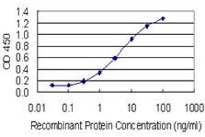 Detection limit for recombinant GST tagged AKR1C1 is 0. (AKR1C1 Antikörper  (AA 1-110))