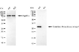 Western blotting analysis using glutathione S-transferase omega 1 antibody (ABIN7798757).