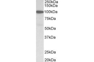 Western Blotting (WB) image for anti-Gelsolin (GSN) (N-Term) antibody (ABIN2465079) (Gelsolin Antikörper  (N-Term))