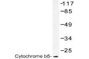 Western blot (WB) analysis of Cytochrome b5 antibody in extracts from A549 cells. (CYB5R3 Antikörper)