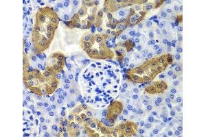 Immunohistochemistry of paraffin-embedded Mouse kidney using KRT19 Polyclonal Antibody at dilution of 1:100 (40x lens). (Cytokeratin 19 Antikörper)