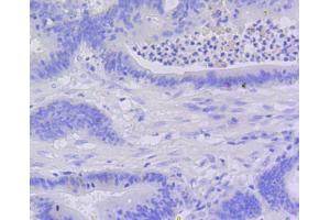 Immunohistochemistry (IHC) image for anti-Caspase 3 (CASP3) antibody (ABIN4903137)