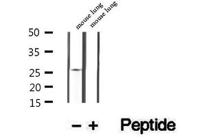 Western blot analysis of extracts of mouse lung tissue, using GSTM4 antibody. (GSTM4 Antikörper  (Internal Region))