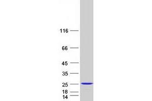 Validation with Western Blot (RAP2B Protein (Myc-DYKDDDDK Tag))