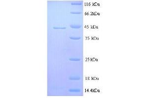 SDS-PAGE (SDS) image for Interleukin 6 (IL6) (AA 30-208), (full length) protein (His tag) (ABIN7479112)