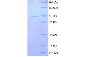 IL-6 (AA 30-208), (full length) protein (His tag) (IL-6 Protein (AA 30-208, full length) (His tag))